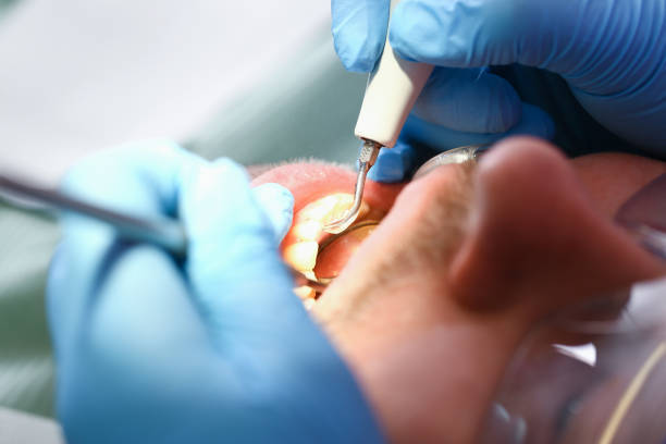 Best Tooth Pain Emergency Relief  in Creston, OH