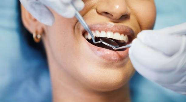 Best Tooth Pain Emergency Relief  in Creston, OH